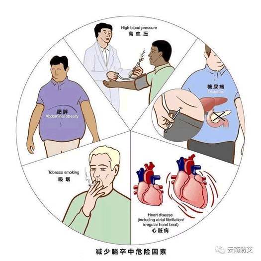 五种人容易     发生心脑血管意外！